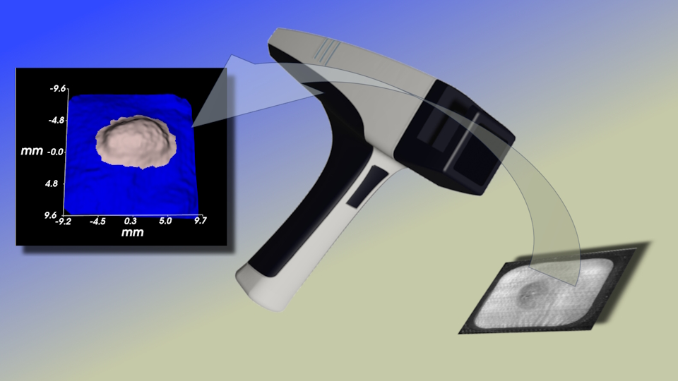 The Budetec TM900v2, successor the Peira TM900, direct optical 3D tumor volume measurement